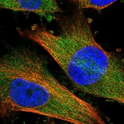 DDO Antibody, Novus Biologicals 0.1mL; Unlabeled:Antibodies, Polyclonal